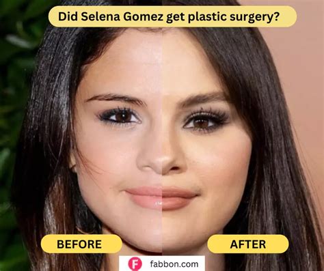 when did selena gomez boobs get so big|Selena Gomez Plastic Surgery Revealed! Before and After